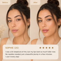 LIP PLUMPER