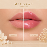 LIP PLUMPER