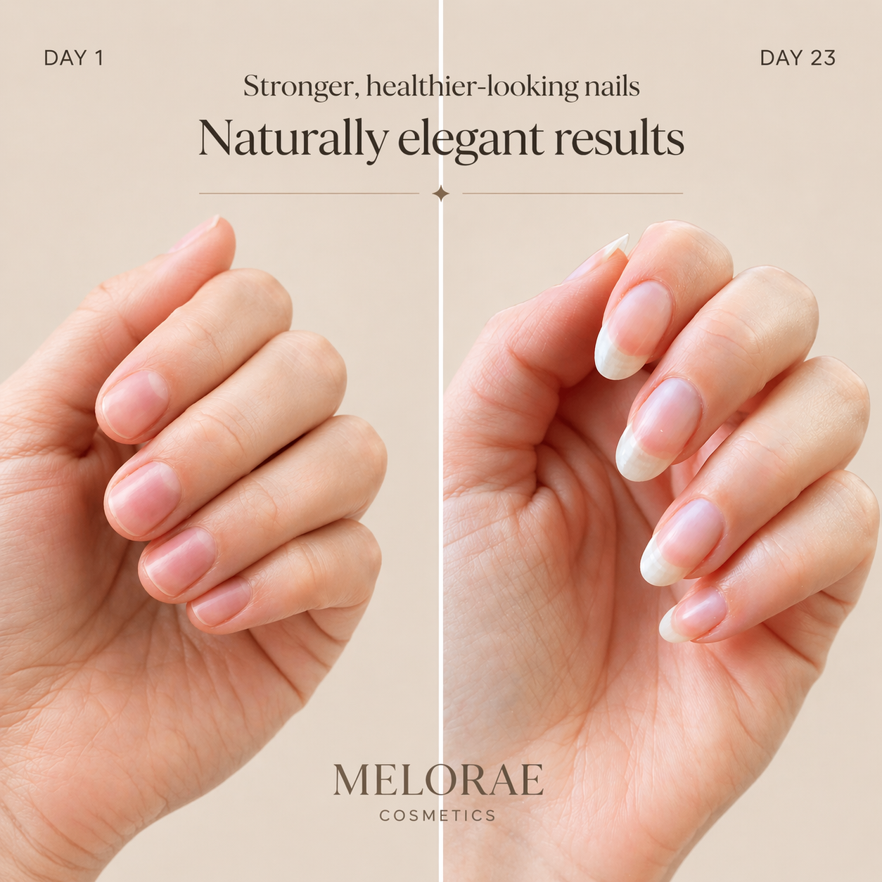 The nailserum difference