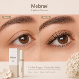 Eye Lash Serum | Melorae